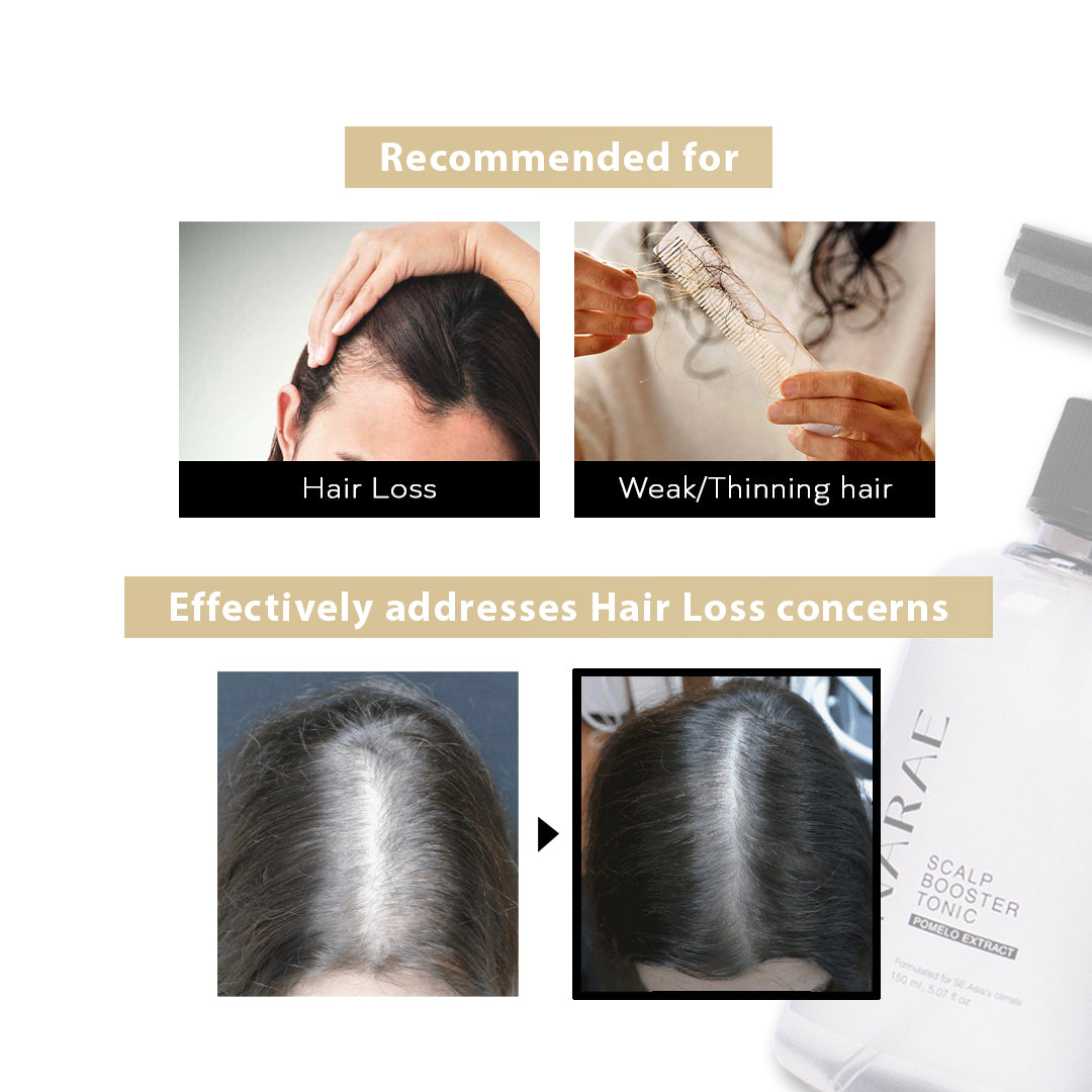 Scalp Booster Hair Tonic 150ml 【For Hair Loss & Scalp Irritation】